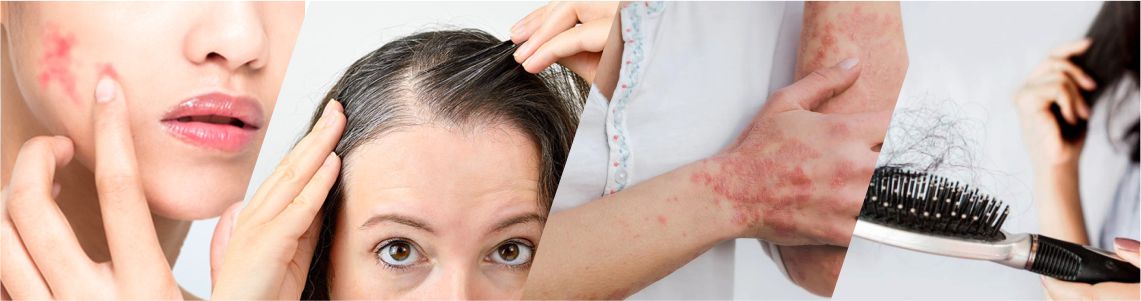Best Skin Care and Hair Care Ayurvedic Treatment, Medicines at BOOKMYYOGA WELLNESS Near Me in DELHI, Delhi